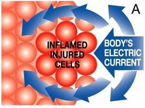 PAINMASTER? | Werkt Uitstekend Tegen Pijnbestrijding Voor Nek, Bovenrug, Onderrug, Schouders, Arm, Knie, Voet, Kuit. Pijnbestrijding ZONDER MEDICIJN. Micro Current Therapie. - Afbeelding 11