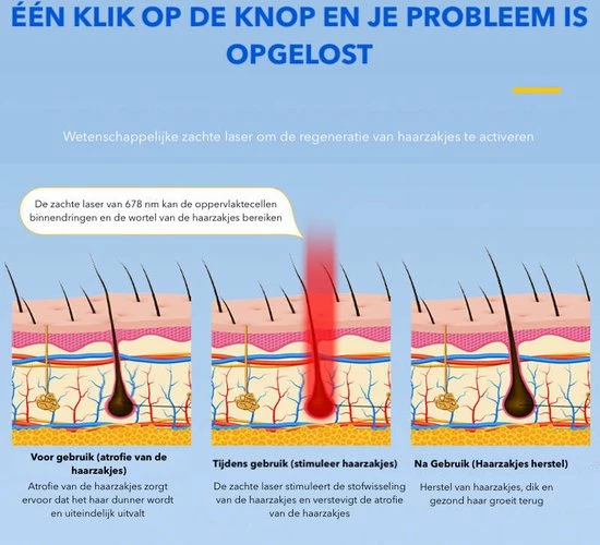 Top Goods - 80 Diode Laserhelm | Lichtgewicht | Tegen Haaruitval | Bevordert De Haargroei - Afbeelding 4
