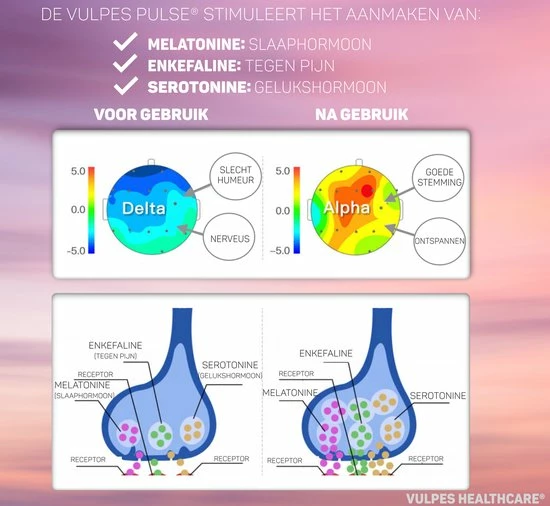 Vulpes Goods Vulpes HealthCare? Sleep & Focus - Slaaphulp - Bevordering Melatonine, Serotonine En Enkefaline Aanmaak - Frequentietherapie En Elektrodentherapie - Verbetert Slaapkwaliteit En Tegen Depressie - 3 Modus En 16 Intensiteitsniveaus En 20 Melodie?n - Afbeelding 11