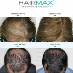 Hairmax Laserband 82 ComfortFlex (BlueEdition - Model 2022) 33 Hairmax Laserband 82 ComfortFlex (BlueEdition - Model 2022) -Beurer store 550x535 11